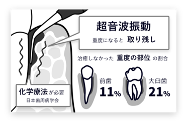 ブルーラジカルの仕組み