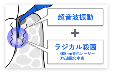 ブルーラジカルの仕組み